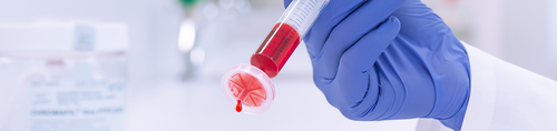 Sample Filtration