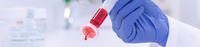 Sample Filtration